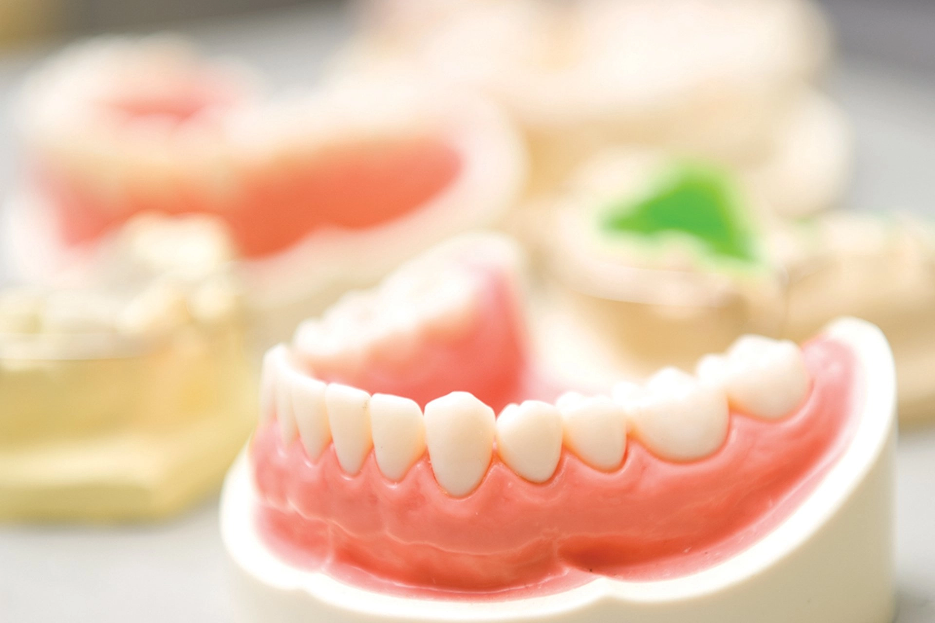 پروتز ثابت متکی بر دندان