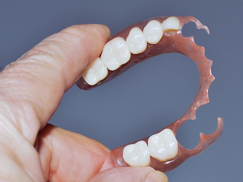 پروتز پارسیل انعطاف پذیر 