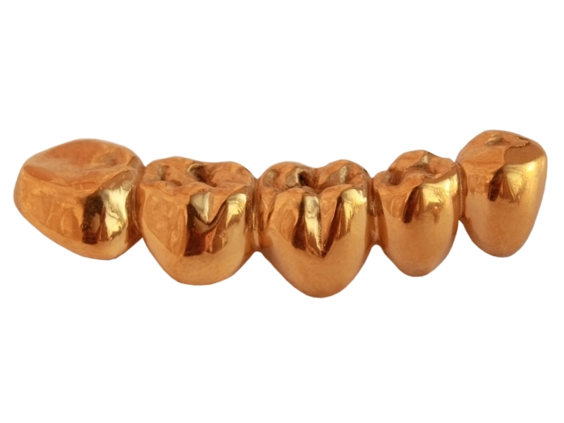 استفاده از طلا برای پر کردن دندان